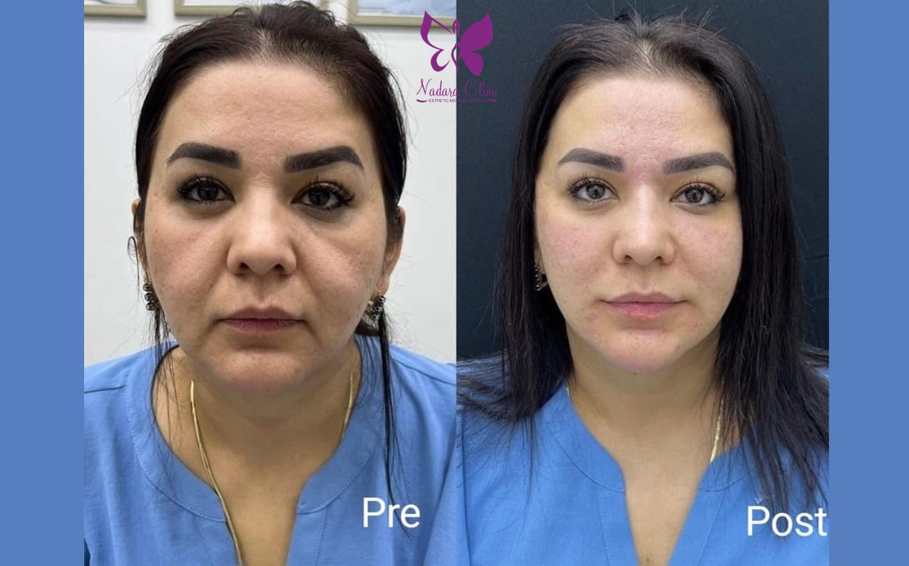 دكتور تجميل في الغردقة